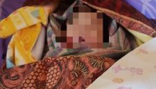 Kondisi fisik bayi yang dinilai tidak wajar, ditemukan adanya lebam kemerahan pada beberapa bagian tubuh, termasuk di pipi kiri, pipi kanan, dan leher. (Dok-Foto)