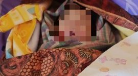 Kondisi fisik bayi yang dinilai tidak wajar, ditemukan adanya lebam kemerahan pada beberapa bagian tubuh, termasuk di pipi kiri, pipi kanan, dan leher. (Dok-Foto)