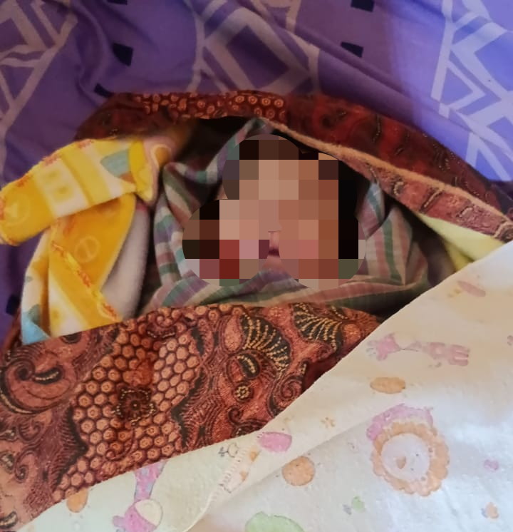 Kondisi fisik bayi yang dinilai tidak wajar, ditemukan adanya lebam kemerahan pada beberapa bagian tubuh, termasuk di pipi kiri, pipi kanan, dan leher. (Dok-Foto)