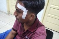 Gambar : Kondisi Rohman Pasca Insiden Penganiayaan Yang Dialaminya (fhoto.dok)