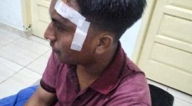 Gambar : Kondisi Rohman Pasca Insiden Penganiayaan Yang Dialaminya (fhoto.dok)