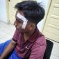 Gambar : Kondisi Rohman Pasca Insiden Penganiayaan Yang Dialaminya (fhoto.dok)