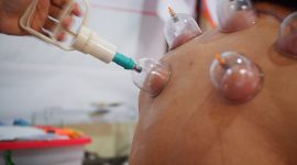 Cara kerjanya dengan menyedot kotoran darah dan zat-zat berbahaya yang menumpuk di dalam tubuh, sehingga aliran darah menjadi lancar kembali. (Dok-Foto)
