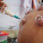 Cara kerjanya dengan menyedot kotoran darah dan zat-zat berbahaya yang menumpuk di dalam tubuh, sehingga aliran darah menjadi lancar kembali. (Dok-Foto)